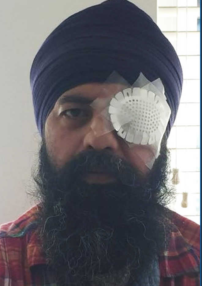 Hate crime charges filed against attackers of Sikh-American techie
