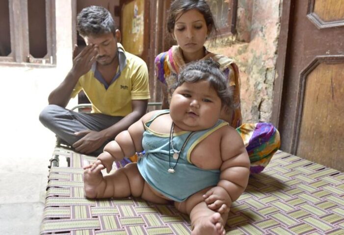 Double the normal weight, nine-month-old Chahat awaits treatment in Amritsar