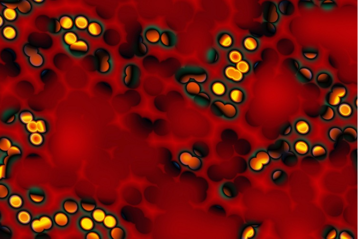 Towards the elimination of hepatitis c as public health concern